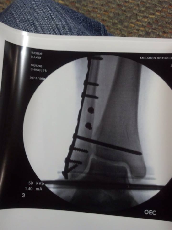 My X Ray